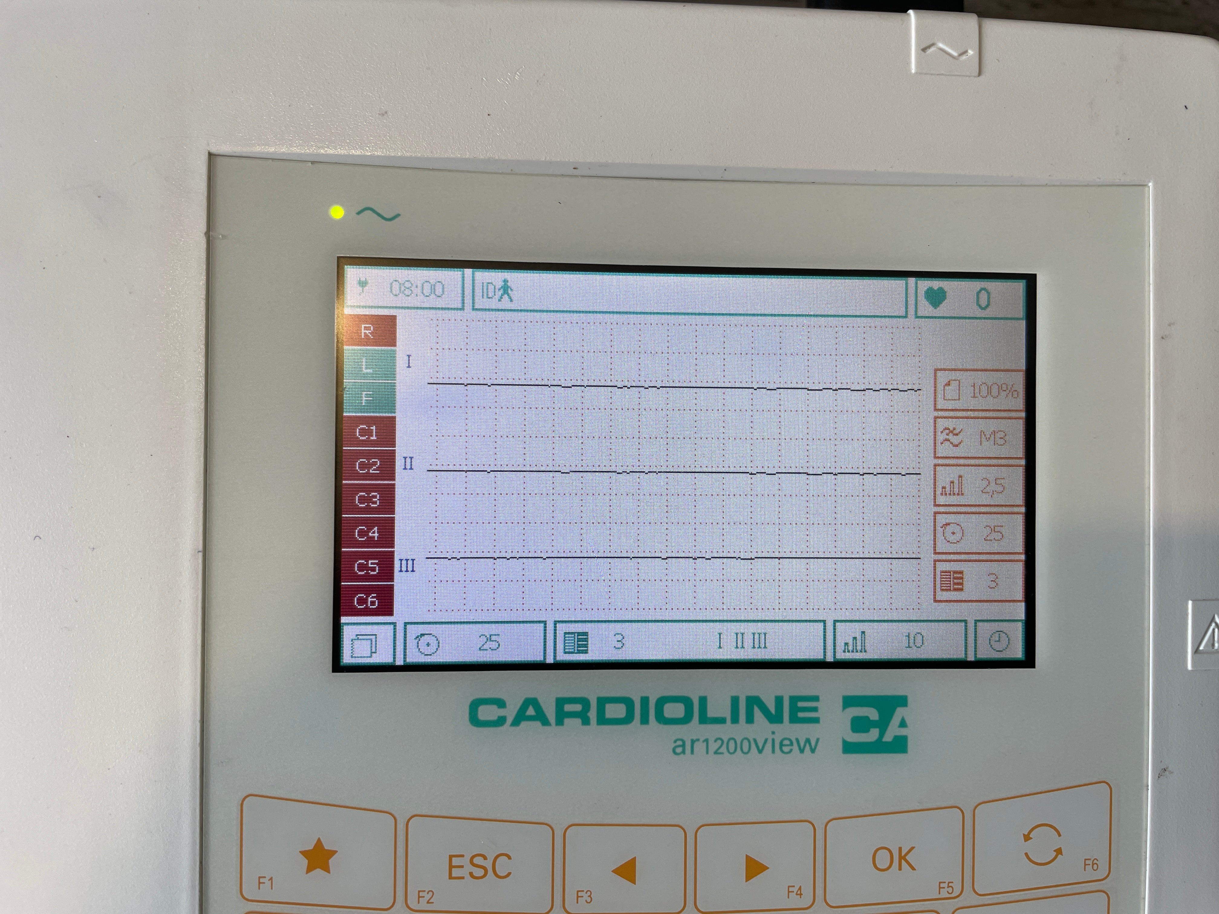 Cardioline-AR1200VIEW-Enregistreur-ECG.jpg