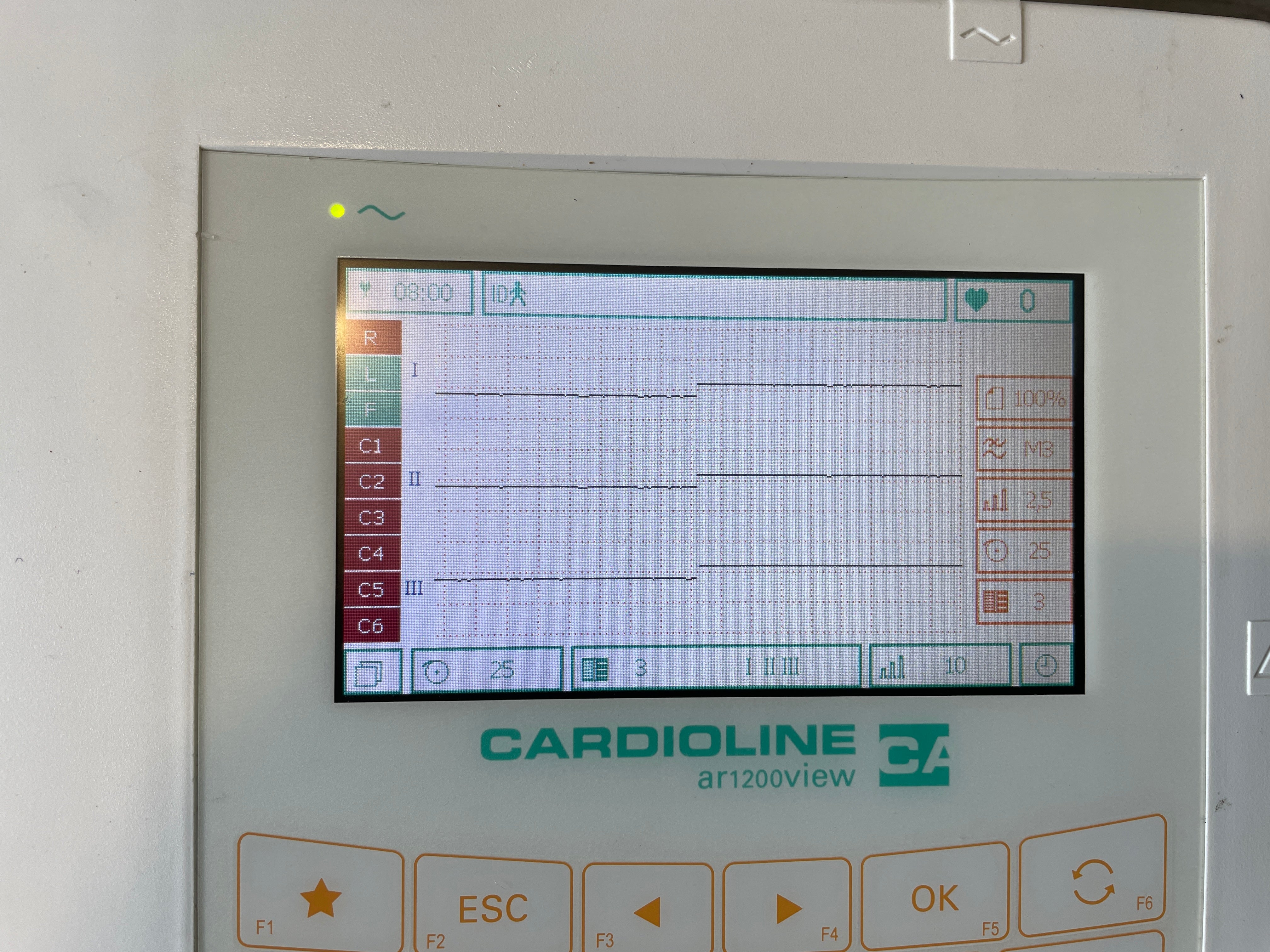 Cardioline-AR1200VIEW-Enregistreur-ECG.jpg